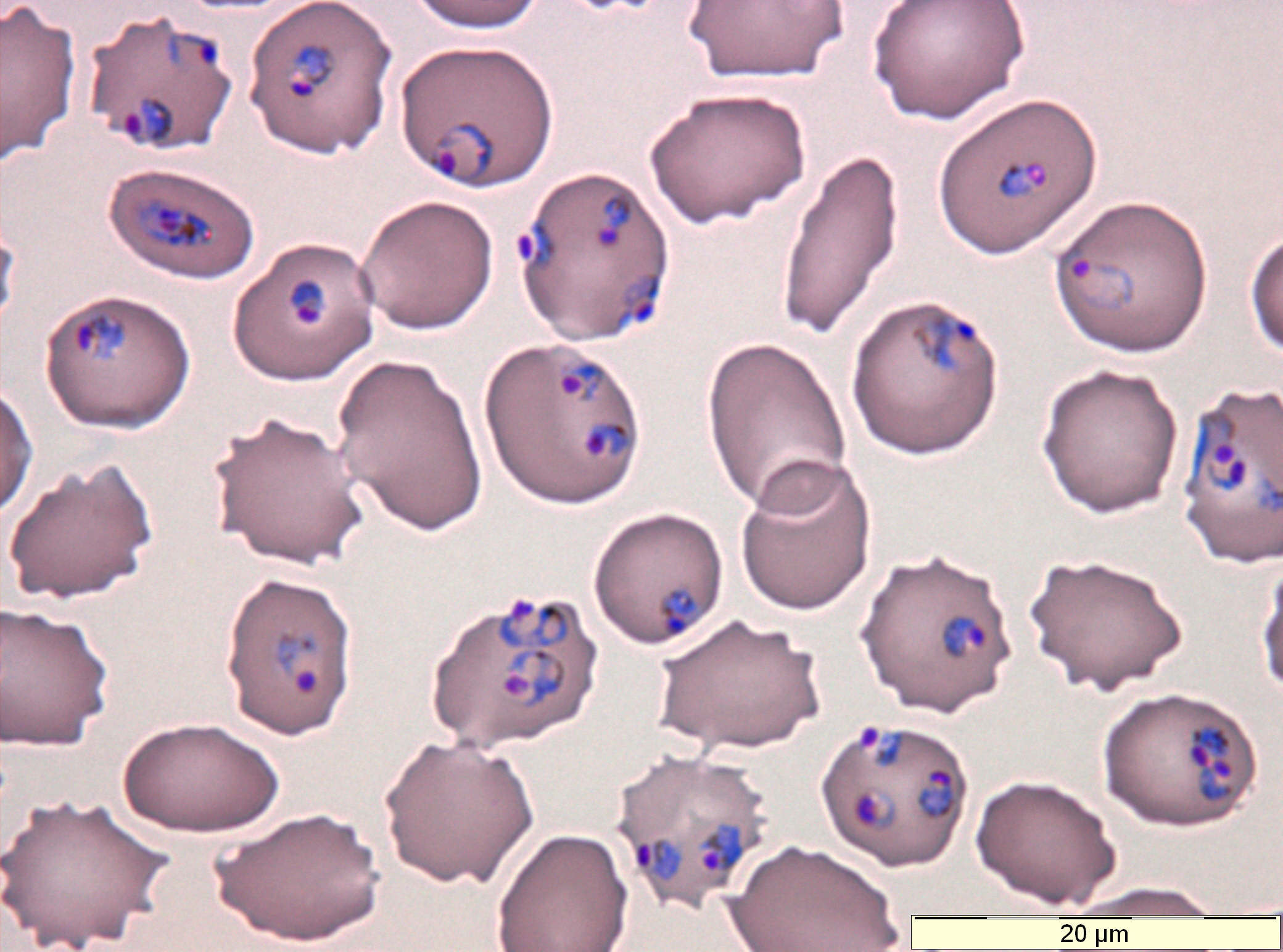 plasmodium-falciparum